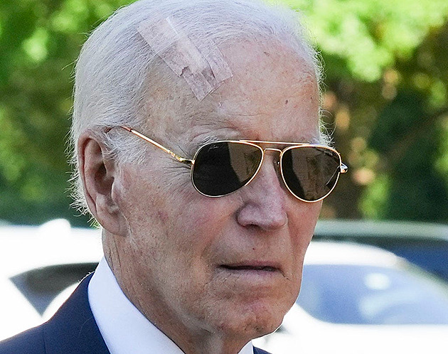 Biden využil Mohsovu chirurgii, kvůli rakovině mu odstranili tkáň z hlavy